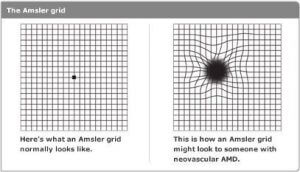 Wet Vs Dry Macular Degeneration - Dupage Eye Associates